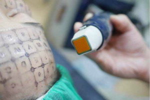 電波拉皮丨名人都愛的抗衰美容儀怎會(huì)讓臉有傷害